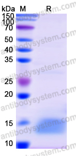 Recombinant Human ZFP36 Protein, N-His