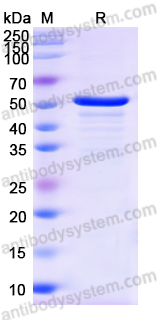 Recombinant Human Monoamine Oxidase B/MAOB/AOFB protein,N-His