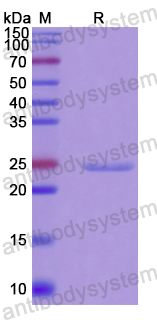 Recombinant Human G0S2 Protein, N-His-SUMO & C-Strep