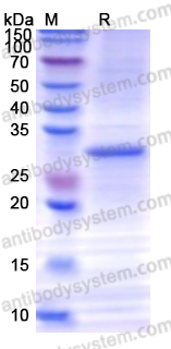 Recombinant Human APEX1 Protein, N-His