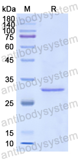 Recombinant Human LOX Protein, N-His