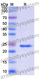 Recombinant Human HTR2C Protein, N-His-KSI