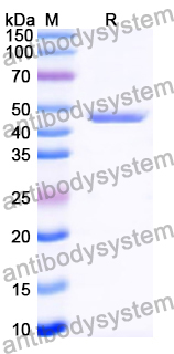 Recombinant Human MSX1 Protein, N-His-KSI