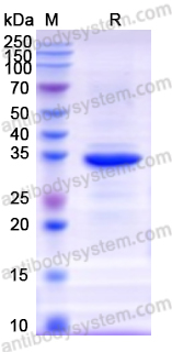 Recombinant Human MAPK1 Protein, N-His