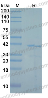 Recombinant Human DUSP1 Protein, N-GST & C-His
