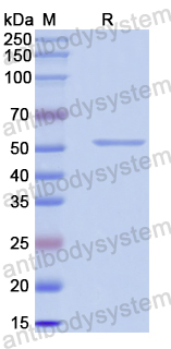 Recombinant Human TPP2 Protein, N-His