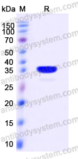 Recombinant Human PTPN6/PTP1C Protein, C-His