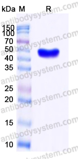 Recombinant Human SERPINB3 Protein, N-His
