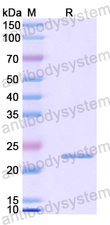 Recombinant Human LMOD1 Protein, N-His