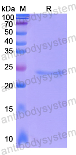 Recombinant Human EEF1D Protein, N-His-SUMO & C-Strep