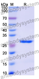 Recombinant Human CNGA1 Protein, N-His