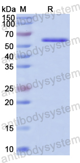 Recombinant Human ALDH4A1 Protein, N-His