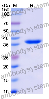 Recombinant Human GCHFR Protein, N-GST & C-His