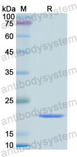 Recombinant Human ATP5F1D Protein, N-His