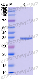 Recombinant Human WEE1 Protein, N-His