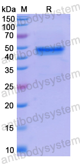 Recombinant Human NMT1 Protein, N-His