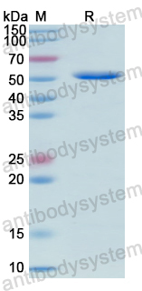 Recombinant Human ADSS2 Protein, N-His