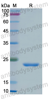 Recombinant Human PKLR Protein, N-His