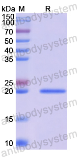 Recombinant Human SRI Protein, N-His