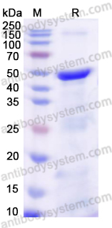 Recombinant Human ALDH1B1 Protein, N-His