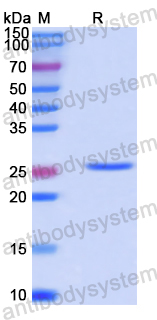 Recombinant Human CHRNB4 Protein, N-His