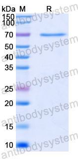Recombinant Human SDHA Protein, N-His