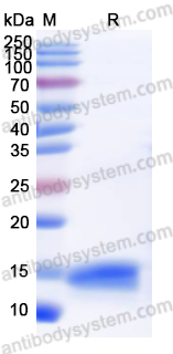 Recombinant Human S100A11 Protein, N-His