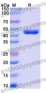 Recombinant Human ARRB2 Protein, N-His