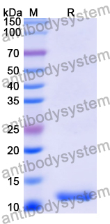 Recombinant Human CCKBR/CCK2-R Protein, N-His