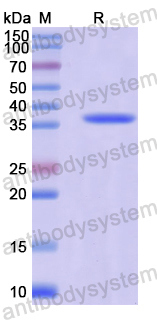 Recombinant Human SLC8A1 Protein, N-His