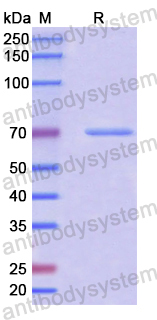 Recombinant Human GBP1 Protein, N-His