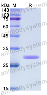 Recombinant Human GBP2 Protein, N-His