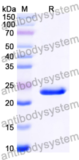 Recombinant Human CD131/CSF2RB Protein, N-His