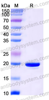 Recombinant Human DUT Protein, Tag free