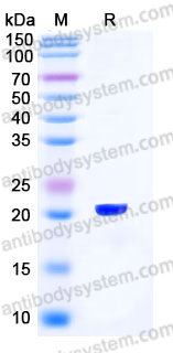 Recombinant Human DUT Protein, N-His
