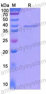 Recombinant Human MCM7 Protein, N-His