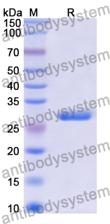 Recombinant Human EVI2B Protein, N-His-KSI