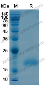 Recombinant Human BTC Protein, N-His