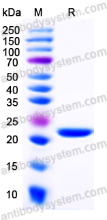 Recombinant Human RCVRN Protein, N-His