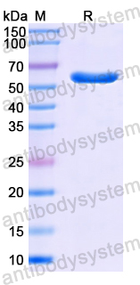 Recombinant Human CBS Protein, N-His