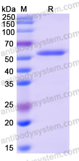 Recombinant Human GCK Protein, N-His