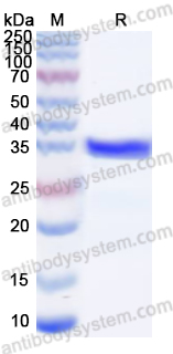 Recombinant Human IRS1 Protein, N-His