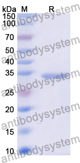 SDS-PAGE for Recombinant Human TIE1 Protein, N-His ?>