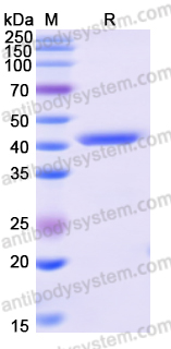 Recombinant Human ACTN2 Protein, N-His