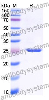 Recombinant Human DEK Protein, N-His-SUMO & C-Strep