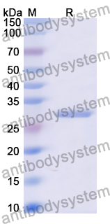 Recombinant Human CHKA Protein, N-His