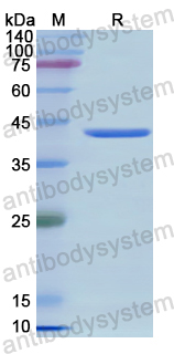 Recombinant Human PPM1A Protein, N-His