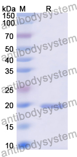 Recombinant Human KRT2 Protein, N-His