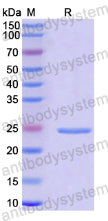 Recombinant Human PDE6B Protein, N-His