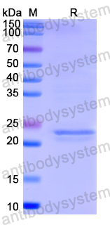 Recombinant Human ARL2 Protein, N-His
